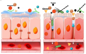 L’inflammation de la paroi intestinale pour les nuls